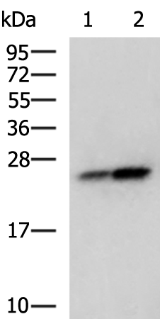 Rabbit Polyclonal Antibody to CDKN1B