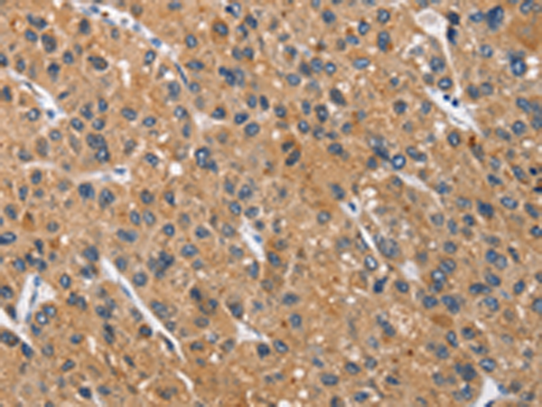 Rabbit Polyclonal Antibody to CEACAM3