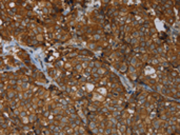 Rabbit Polyclonal Antibody to ERBB4