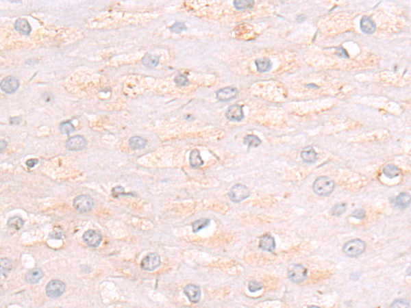 Rabbit Polyclonal Antibody to ERBB3