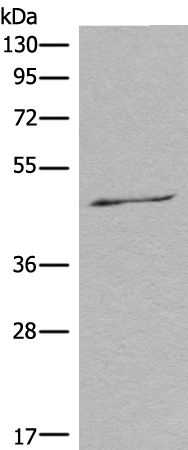 Rabbit Polyclonal Antibody to FOS