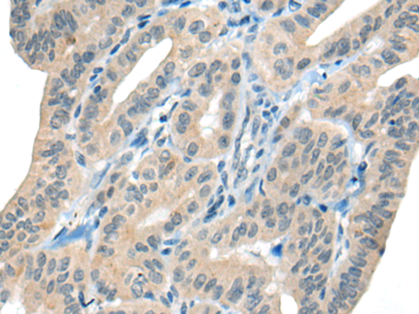 Rabbit Polyclonal Antibody to CHAT