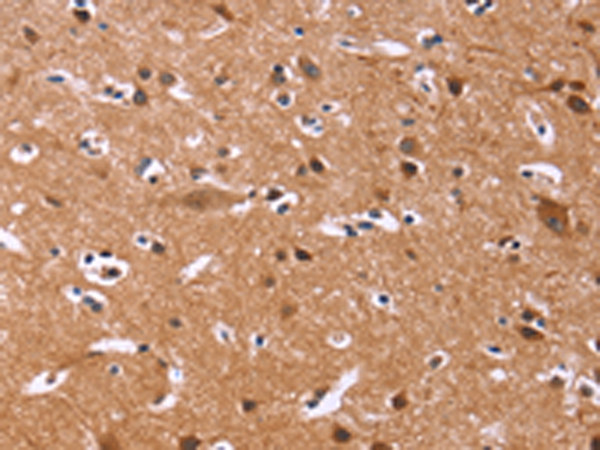 Rabbit Polyclonal Antibody to CHRM1