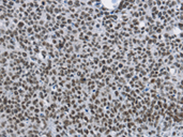 Rabbit Polyclonal Antibody to CMTM2