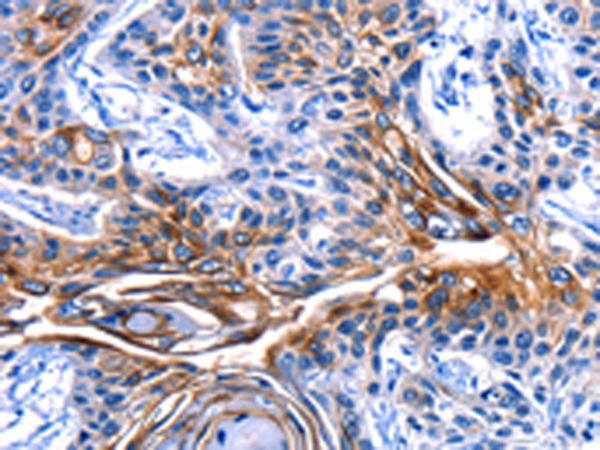 Rabbit Polyclonal Antibody to CLCA4
