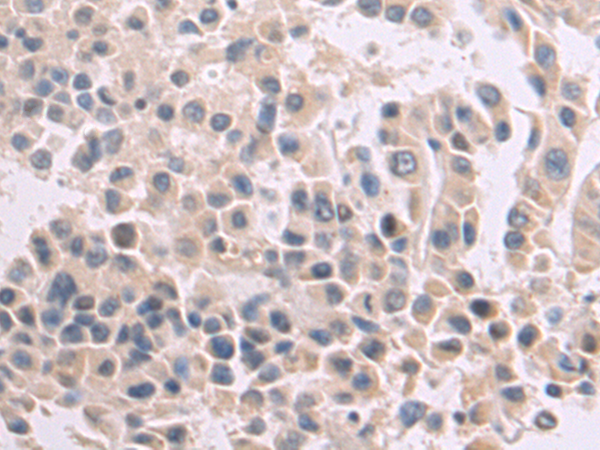 Rabbit Polyclonal Antibody to CLEC1A
