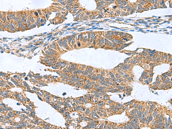Rabbit Polyclonal Antibody to CLEC1B