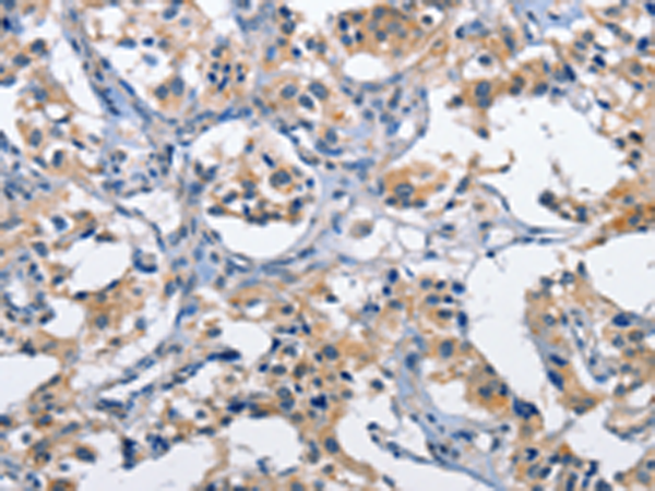 Rabbit Polyclonal Antibody to CLEC2D