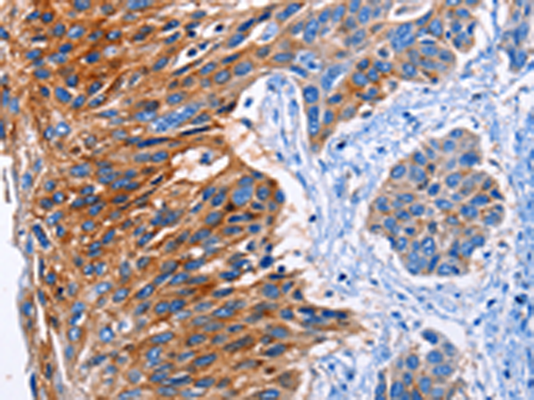 Rabbit Polyclonal Antibody to CLEC2B