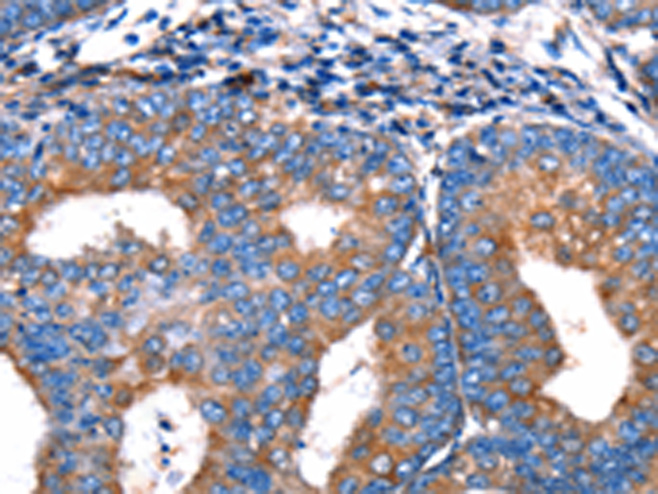 Rabbit Polyclonal Antibody to MERTK