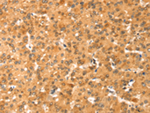 Rabbit Polyclonal Antibody to COLEC11