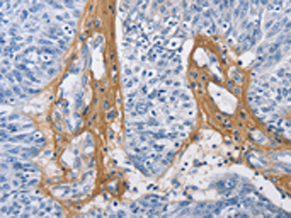 Rabbit Polyclonal Antibody to COL3A1