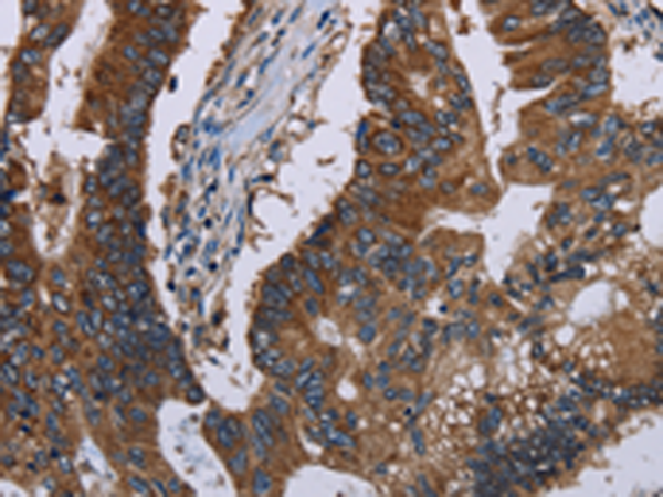 Rabbit Polyclonal Antibody to CLDND1