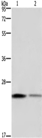 Rabbit Polyclonal Antibody to EMC8