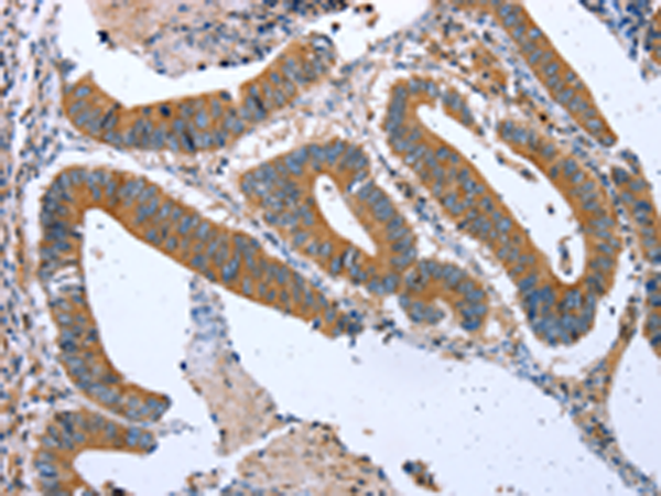 Rabbit Polyclonal Antibody to CPT1A