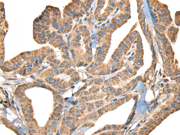 Rabbit Polyclonal Antibody to SLAMF7