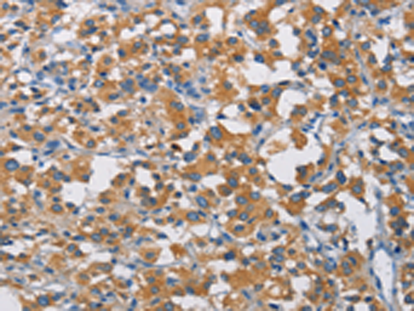 Rabbit Polyclonal Antibody to CRTAM