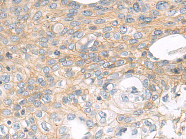 Rabbit Polyclonal Antibody to CD151