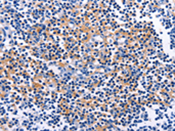 Rabbit Polyclonal Antibody to CUL5