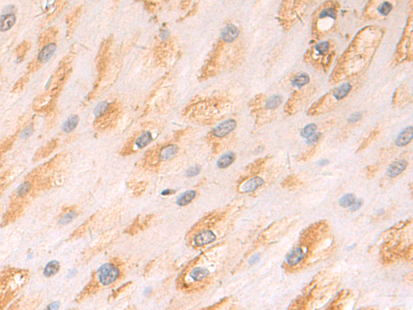 Rabbit Polyclonal Antibody to GJA5