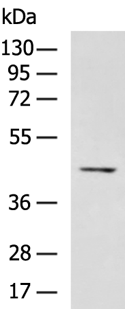 Rabbit Polyclonal Antibody to CXCR3