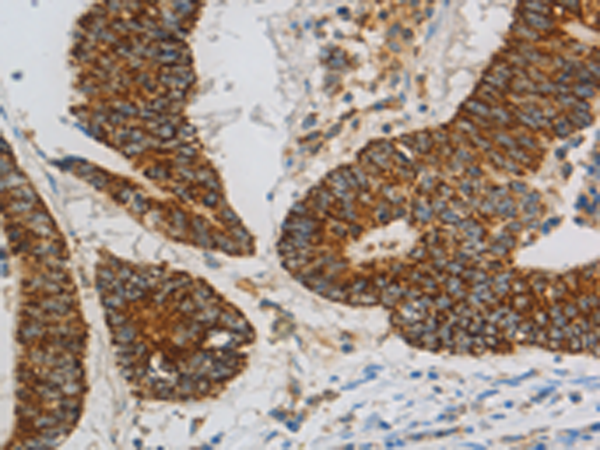 Rabbit Polyclonal Antibody to CCNF