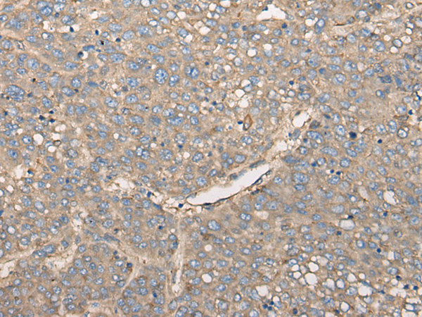 Rabbit Polyclonal Antibody to CCNJ