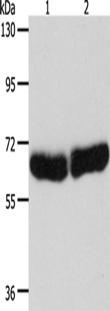 Rabbit Polyclonal Antibody to CYP1B1