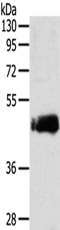 Rabbit Polyclonal Antibody to ENTR1