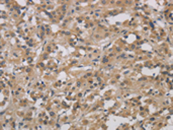 Rabbit Polyclonal Antibody to DCN