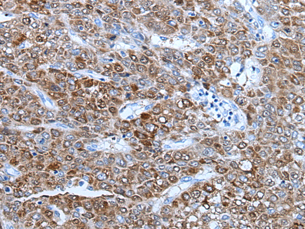 Rabbit Polyclonal Antibody to TNFRSF10C