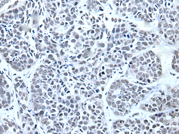 Rabbit Polyclonal Antibody to DDB2