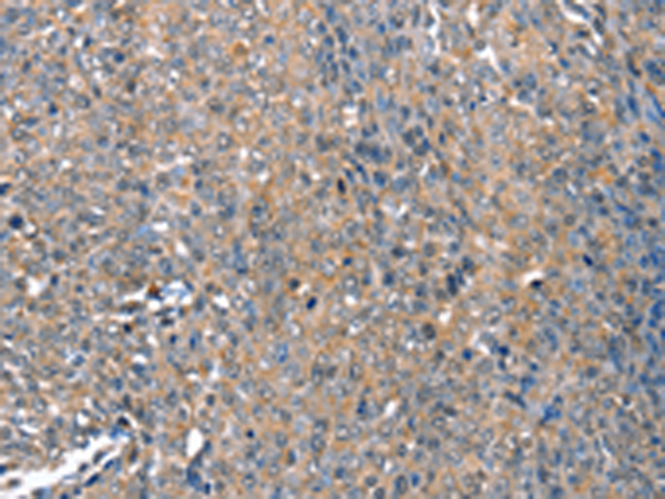 Rabbit Polyclonal Antibody to DEFA1