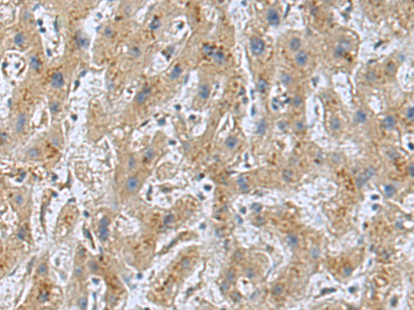 Rabbit Polyclonal Antibody to DTX2