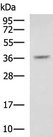 Rabbit Polyclonal Antibody to DKK1