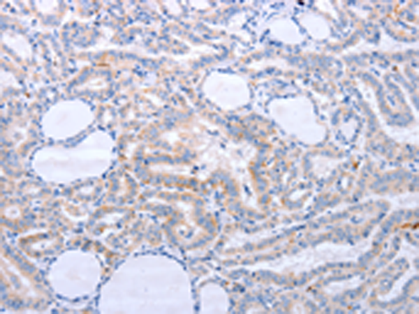 Rabbit Polyclonal Antibody to DNMT3L