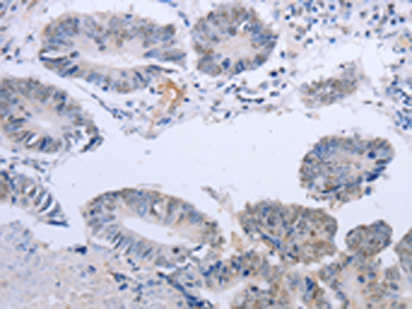 Rabbit Polyclonal Antibody to DOK5