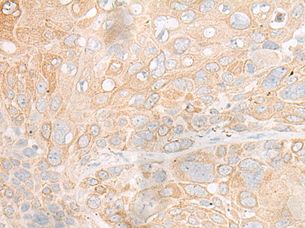 Rabbit Polyclonal Antibody to DOK4