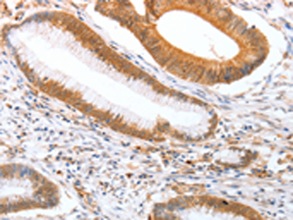 Rabbit Polyclonal Antibody to DPPA2