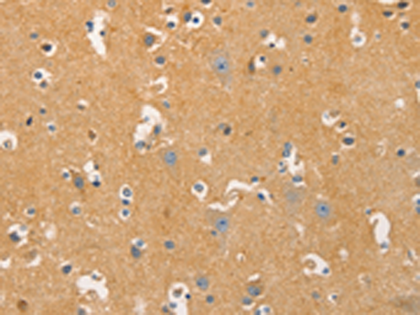 Rabbit Polyclonal Antibody to DNM3