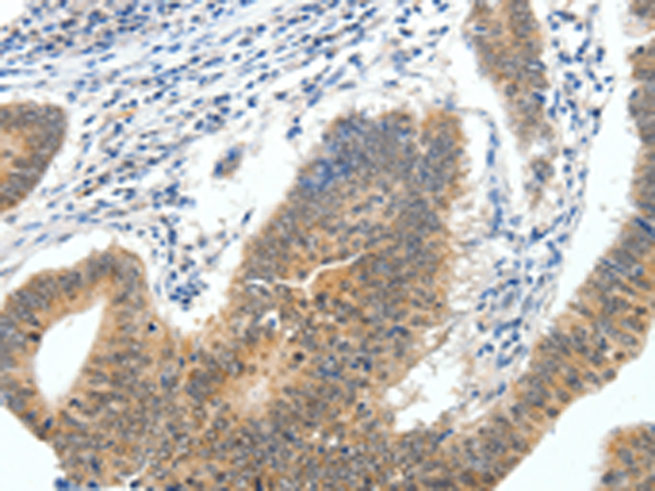 Rabbit Polyclonal Antibody to EEF1AKMT4