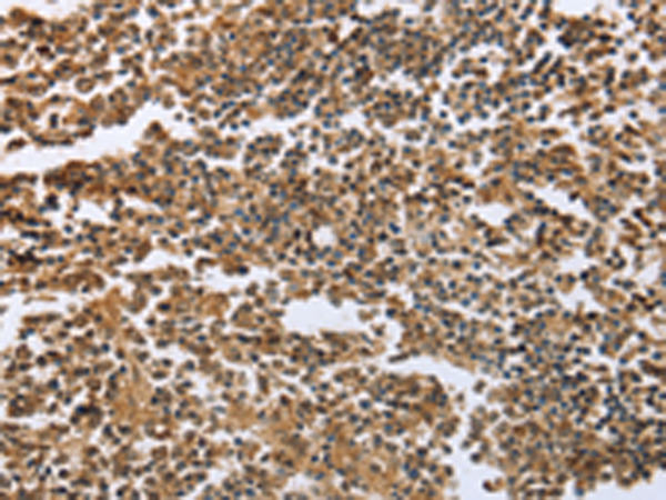 Rabbit Polyclonal Antibody to ECE1