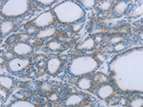 Rabbit Polyclonal Antibody to EGFL7