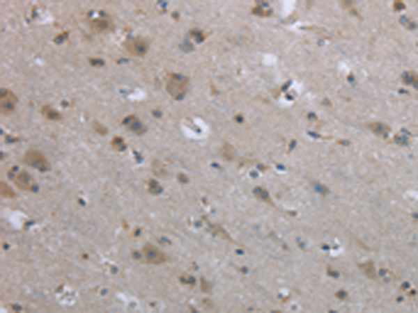 Rabbit Polyclonal Antibody to EGFL8