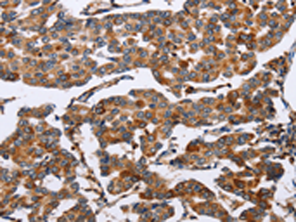Rabbit Polyclonal Antibody to ENPP5