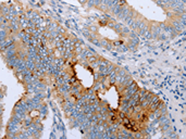 Rabbit Polyclonal Antibody to ENPP6