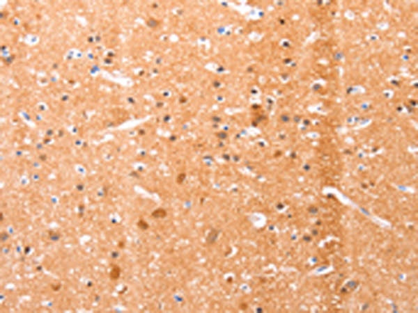 Rabbit Polyclonal Antibody to EFNA1