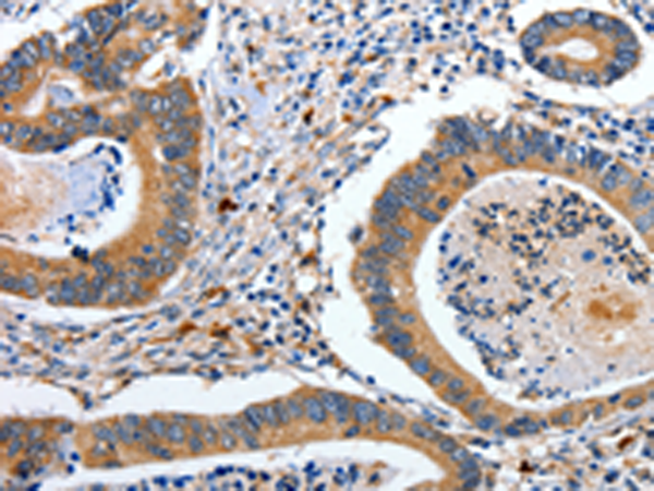 Rabbit Polyclonal Antibody to EFNB2