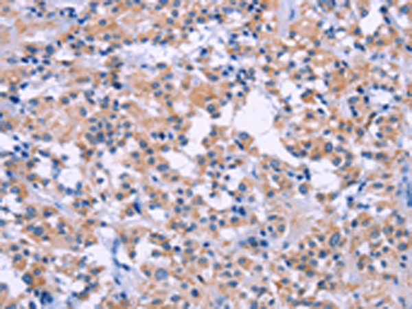 Rabbit Polyclonal Antibody to DUSP22
