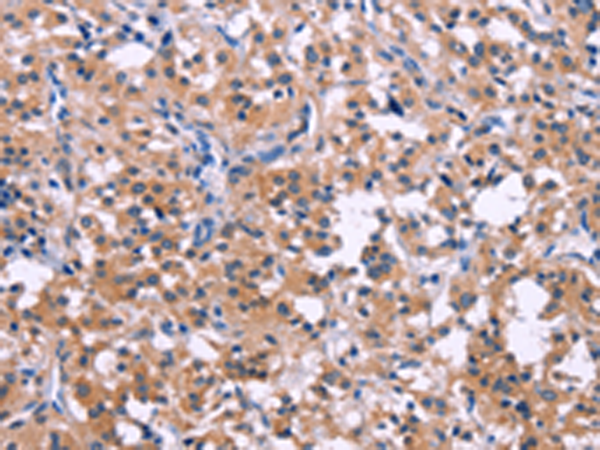 Rabbit Polyclonal Antibody to DUSP13
